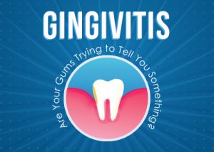 Spring dentists at Spring Creek Dentistry tells patients about gingivitis—causes, symptoms, and treatments to help get your gums healthy.