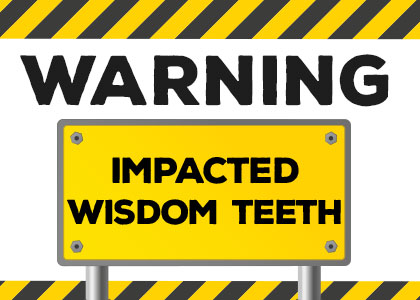 Spring dentists at Spring Creek Dentistry explain what signs might mean you have impacted wisdom teeth and if you might need them extracted.