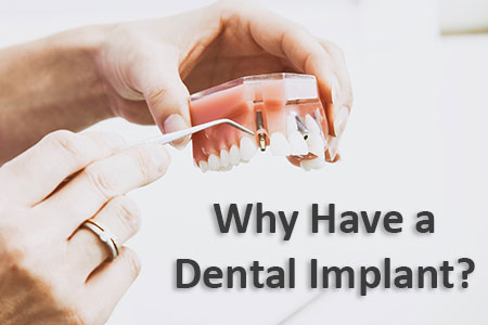 Spring Creek Dentistry explain when a dental implant is the needed step